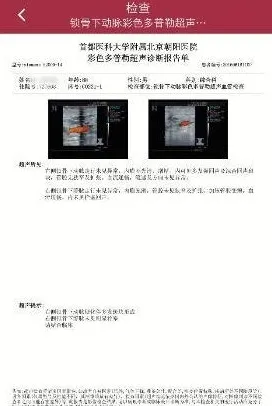 ����������(ҽ�ƽ�������)