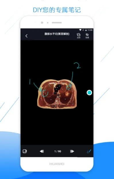 影像解剖图谱(医学影像学习平台)